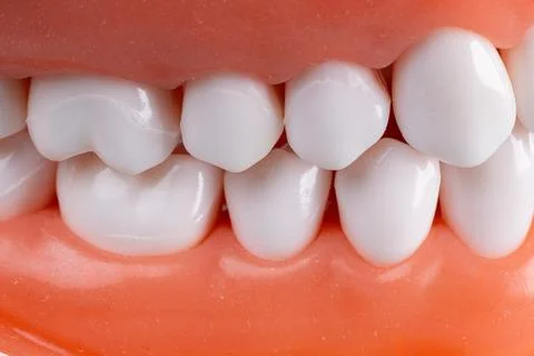 Photo of a set of false teeth with white teeth. Stock Photos