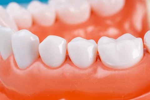 Photo of a set of false teeth with white teeth. Stock Photos
