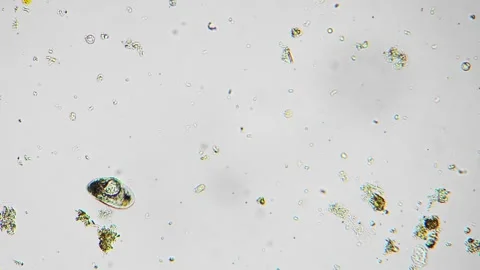 Photomicrograph capturing complex internal design and external silica shell of Stock Footage 344086413