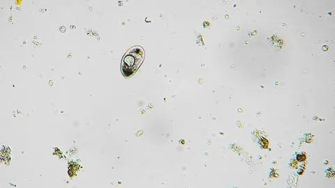 Photomicrograph capturing complex internal design and external silica shell of Фото