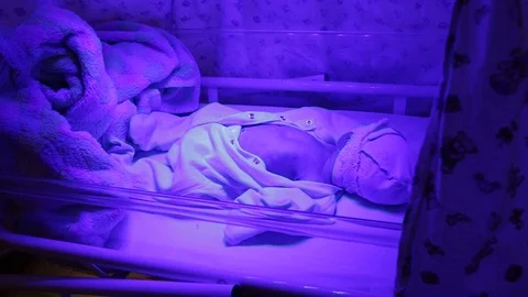 Phototherapy for newborn Stock Footage 85633681