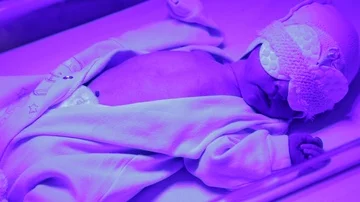 Phototherapy for newborn Stock Footage 85633690