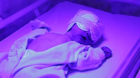 Phototherapy for newborn Stock Footage 87130778