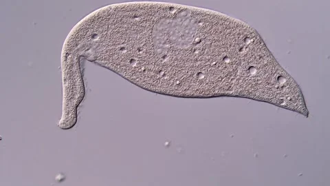 Phylum ciliophora: Dileptus under the microscope 库存影片 310491809