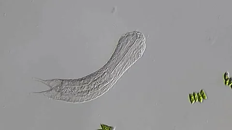 Phylum Gastrotricha (Pond water sample 400x magnification) 스톡 동영상 306585946
