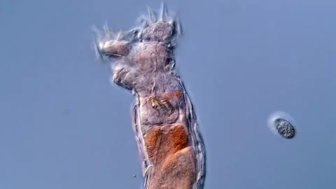 Phylum rotifera: microscopy view 400x magnification Vidéo 310309903
