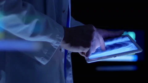 Physician analyzing patient's lungs in the image on a device Stock Footage 67262705