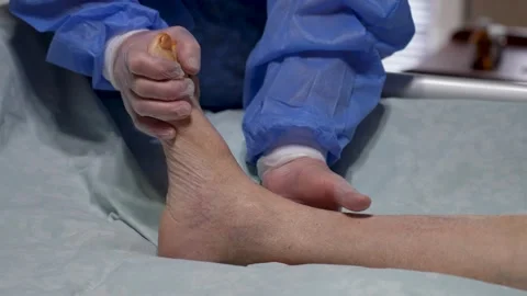 Physician Examining Bare Ankle After Surgery. Medical professional performs.. Stock Footage 329907807