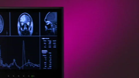 Physician studies 3 brain scans CU Stock Footage 459136