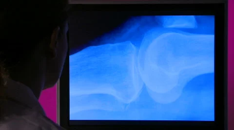 Physician studies bone scan cu Stock Footage 459190