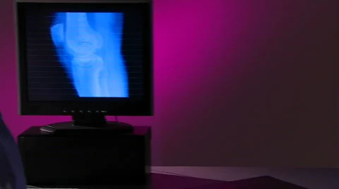 Physician studies points to bone scan Stock Footage 459253