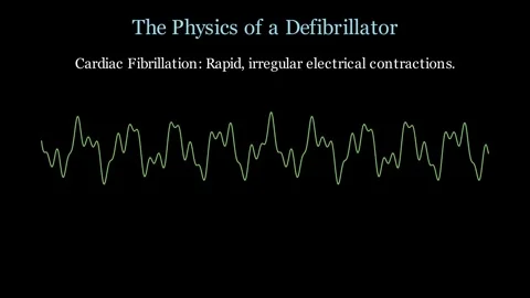 The Physics of a Defibrillator Stock Footage 337755848