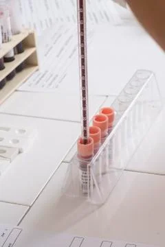 Physiological test in a lab Stock Photos