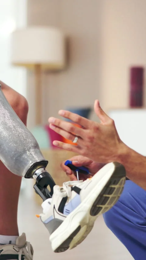 Physiotherapist, hands or prosthetic leg with people, talking or rehabilitation Stock Footage 332324482