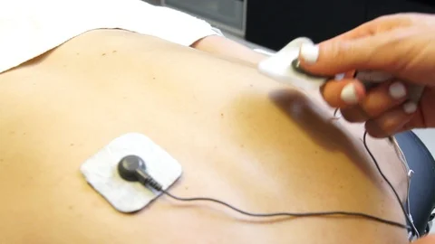 Physiotherapist Puts Electrodes For Electro Stimulus On The Back 스톡 동영상 97852025