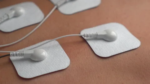 Physiotherapy of the back with TENS electrode pads Stock Footage 150306920