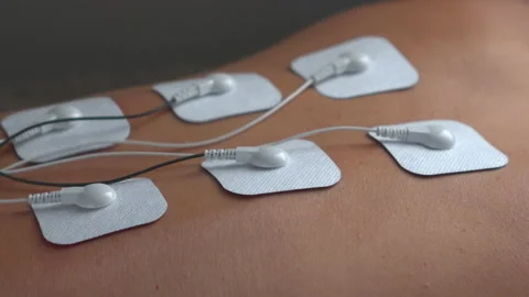 Physiotherapy of the back with TENS myostimulator, electrical nerve stimulation. Stock Footage 150650570