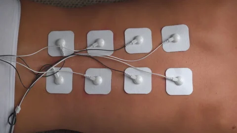 Physiotherapy of the back using electrical-stimulation TENs of electrode pads. Stock Footage 149882085