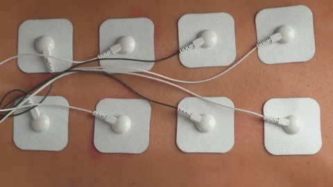 Physiotherapy of the back using electrical-stimulation TENs of electrode pads. Stock Footage 150172545