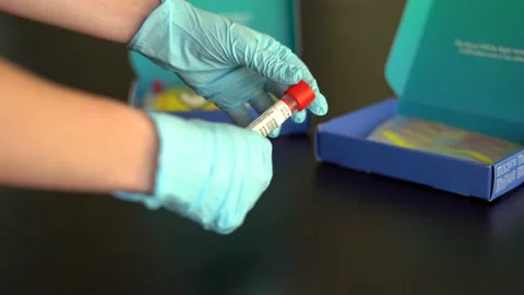 Picking up and analyzing a COVID19 test vial with disposable gloves on. 库存影片 157767840