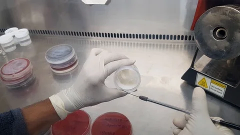Picking up of pus sample from a sample container using an inoculation loop Stock Footage 127380513