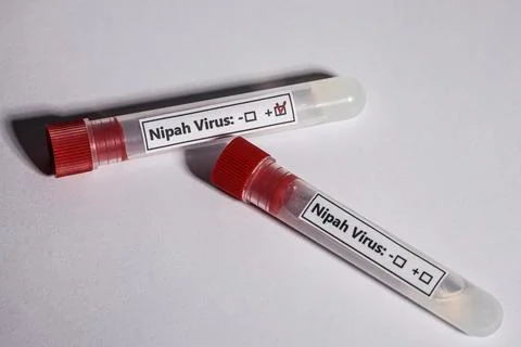 In the picture on a white background, two test tubes with the Nipah virus are Stock Photos