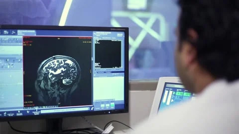 Pictures of the brain scan on the monitor. Stock Footage 143331473