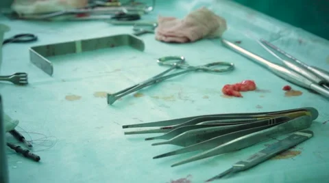 Piece of human fat on a table with surgical instruments 스톡 동영상 67215658