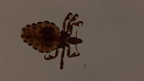 Pig louse with antennae Stock Footage 292281774