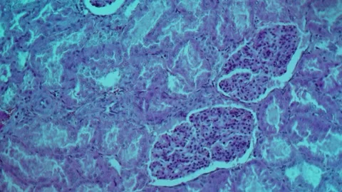 Pike kidney in cross section Stock Footage 343129453