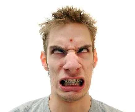 Pimple on forehead Stock Photos