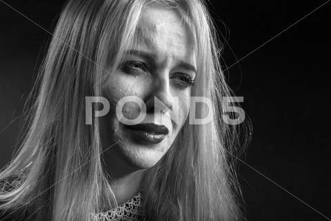 Pimply skin crying Stock Photos