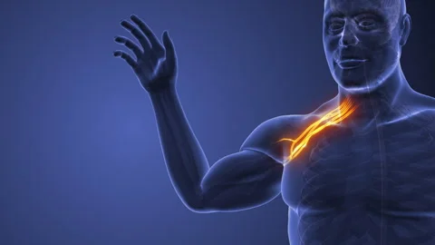 Pinched Nerve in Cervical Spine Triggering Symptoms Stock Footage 304622057