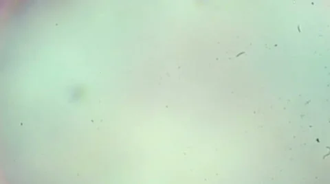 Pine needle cross-section under the micr... | Stock Video | Pond5