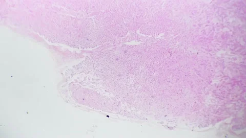Pineal body of human being in section shown under biological microscope 40x on Stock Footage 229029922