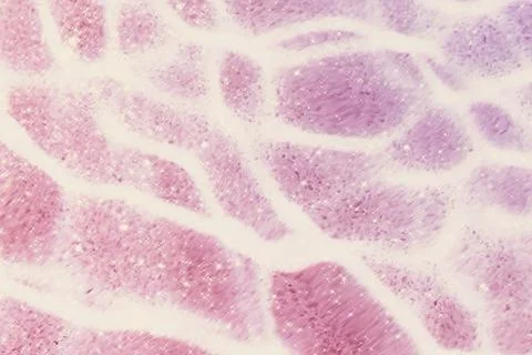 Pink aesthetic glittery pattern background Foto stock