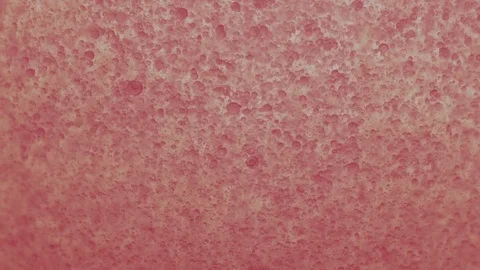 Pink Floating Micro Bubbles In Different Sizes Stock Footage 84144530