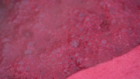 Pink foam for red currant jam. red currant are boiled in a pot with sugar. Vidéo 279112230