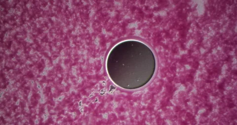 Pink Microbial Colony Under Microscope at 100x Magnification Stock Footage 294263677