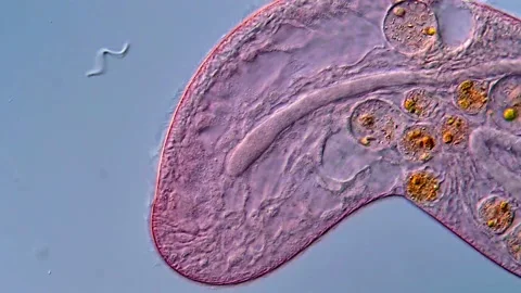 Pink protozoa microorganism under microscopy view, Blepharisma 400x Vidéo 317633780