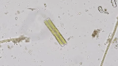 Pinnularia diatom algae under the microscope Stock Footage 266407298