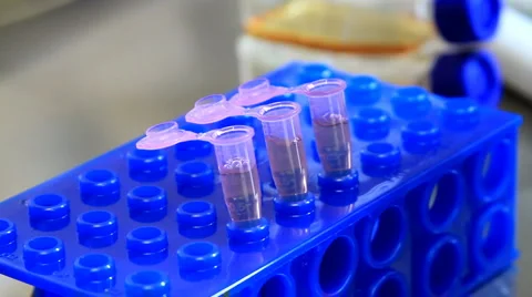 Pipete 스톡 동영상 935591