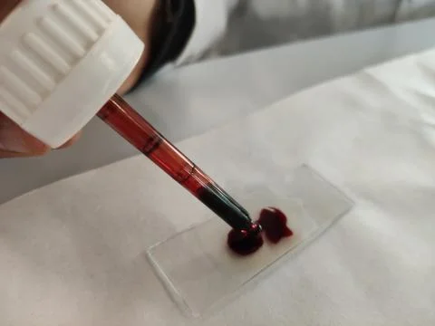 A pipette dropping a sample into a slide in a laboratory Stock Photos