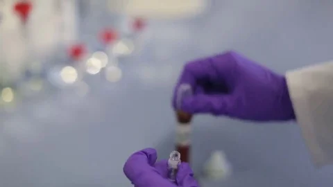 Pipette Filling Vial with Solution Stock Footage 69087793