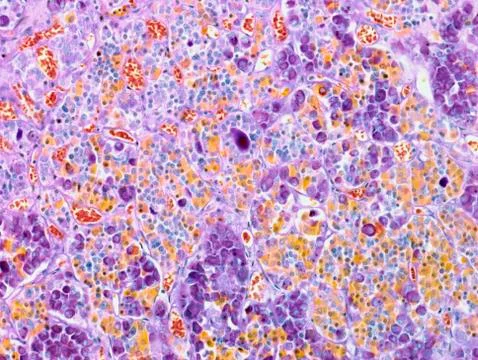 Pituitary gland, light micrograph Stock Photos