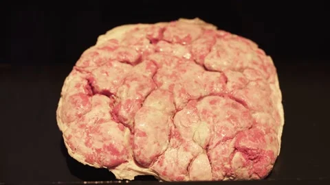Placenta from the mother's side Video stock 152679649