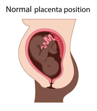 Placental Locations Stock Illustration