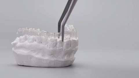 Placing clear orthodontic aligner on plaster dental model using tweezers Stock Footage 340052372