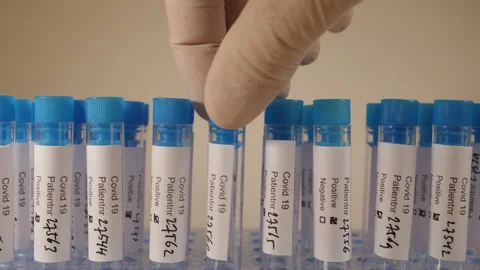 Placing a test tube with positive sample in rack of Corona virus test tubes. Stock Footage 142232972