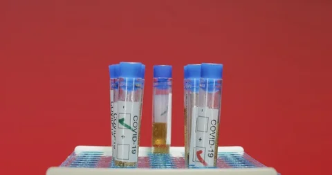 Placing vial of COVID-19 testing material in laboratory setting Stock Footage 127676353